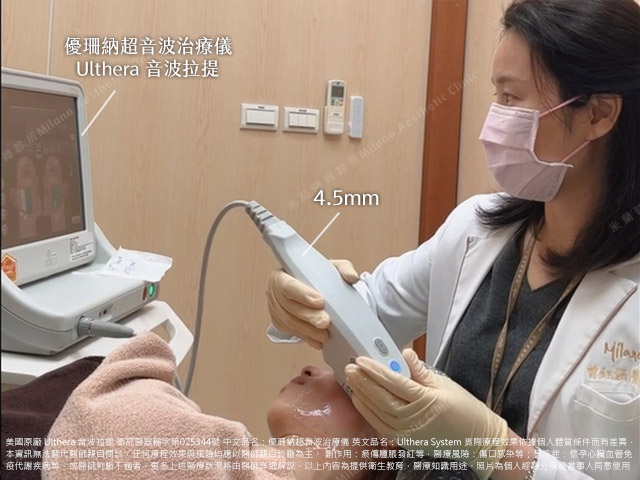 Ulthera音波拉提