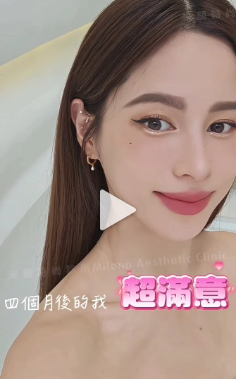 女神Nikki腫脹但超期待效果