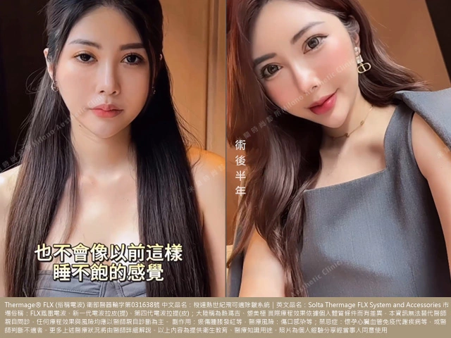 眼周電波術前術後比較