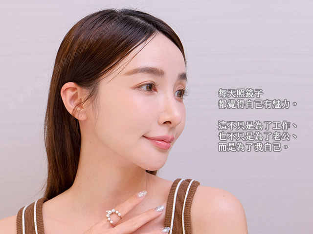 彭彭接受三波拉提療程後的改善正面照