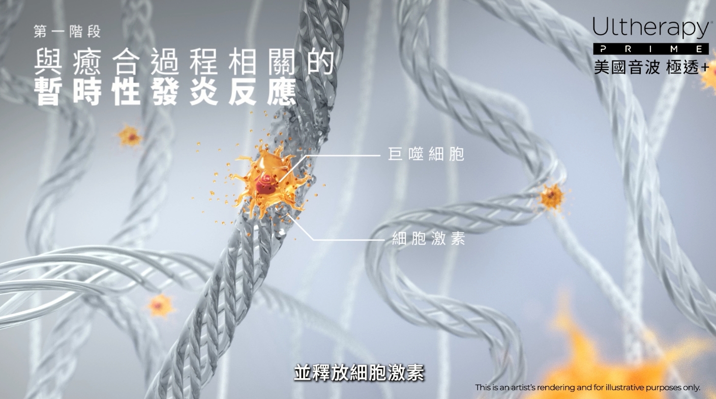 暫時性發炎反應期