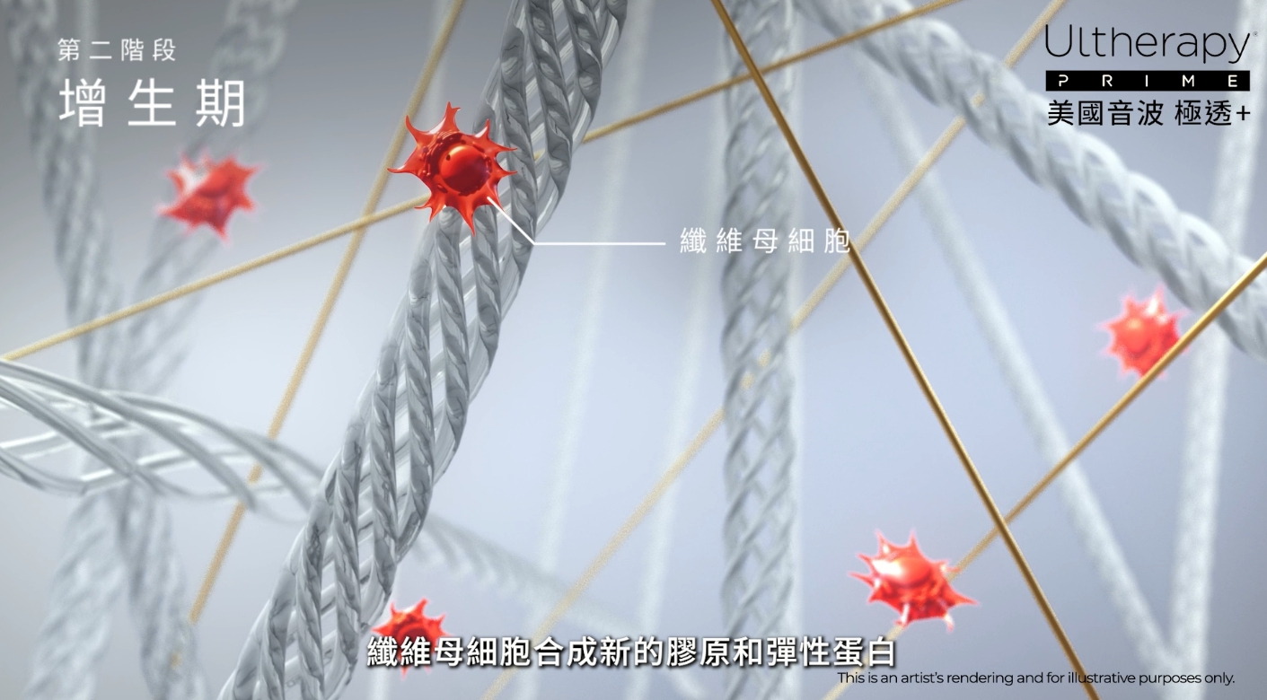 增生期