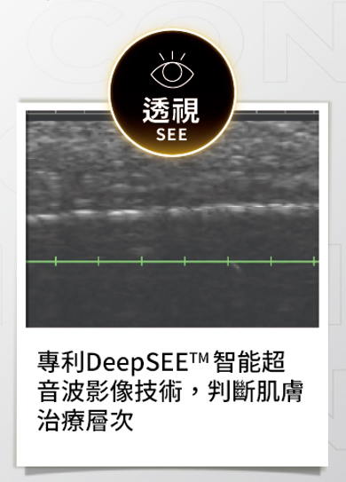 透視