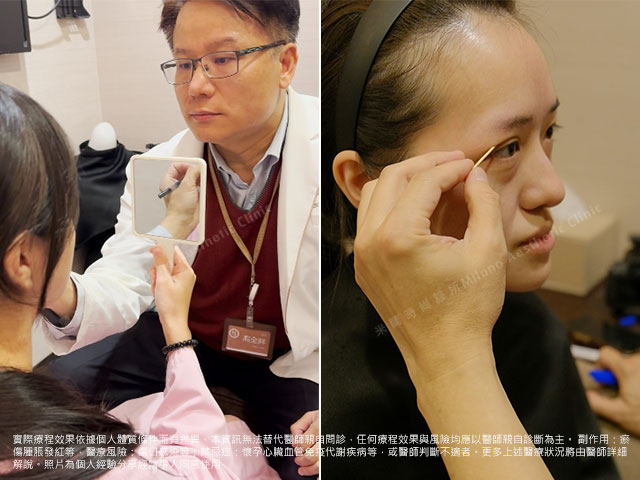 高全祥醫師術前諮詢