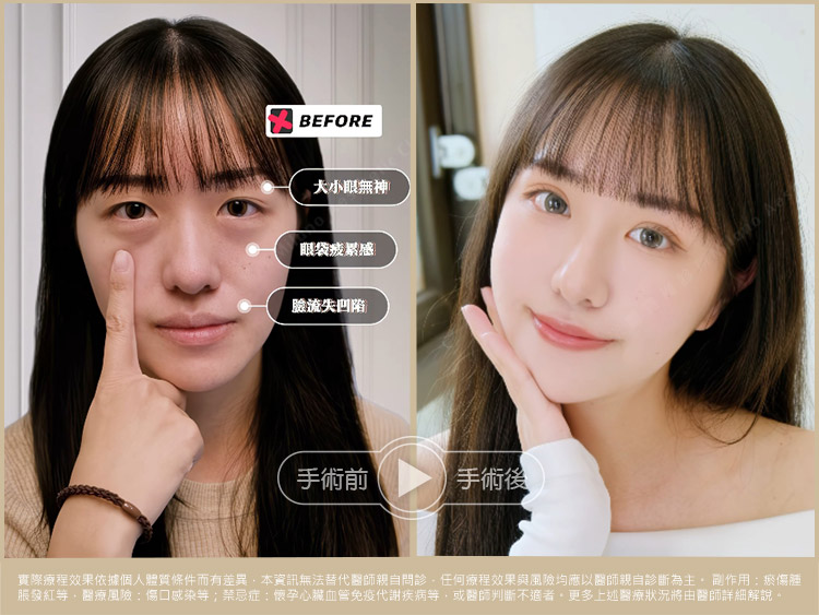 術前術後比一比 照片