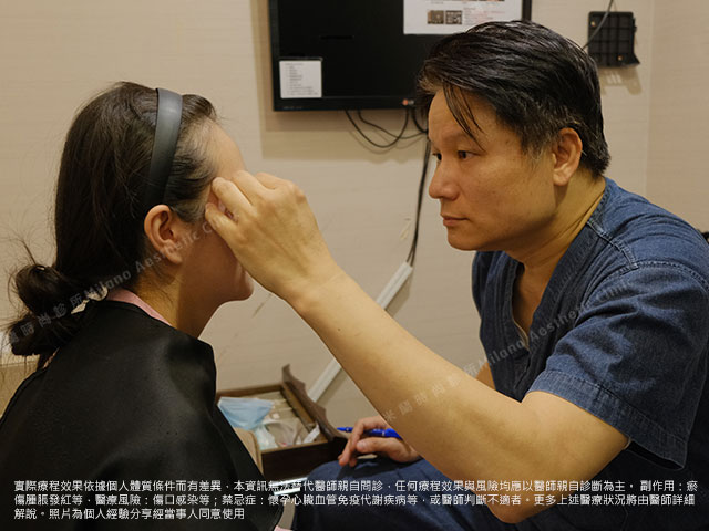 術前護理人員會再次說明手術相關風險及注意事項~20分鐘的麻藥