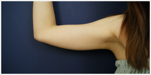 手臂大部分可以抽取的脂肪部位是在下方