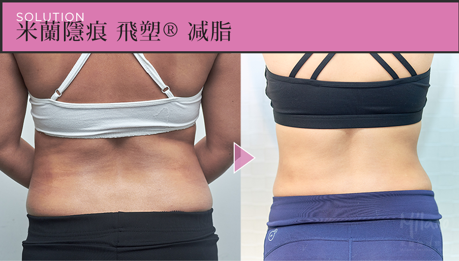 術後兩個月
