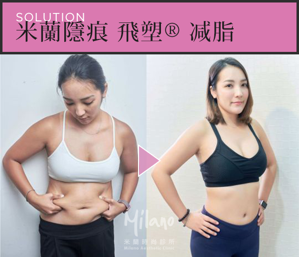 王彥博醫師 快甩大肚腩案例