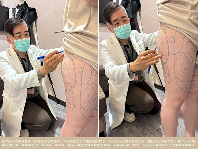 莊昆霖醫師術前諮詢與評估