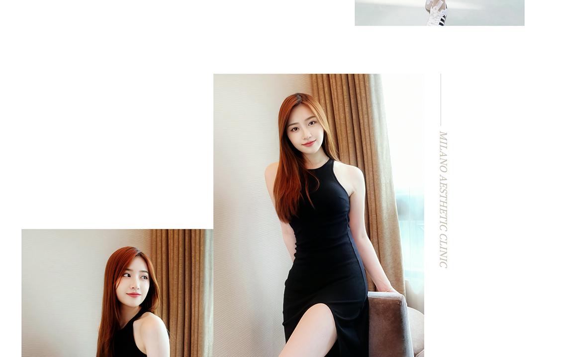 素人Jessica－威塑抽脂術後生活照