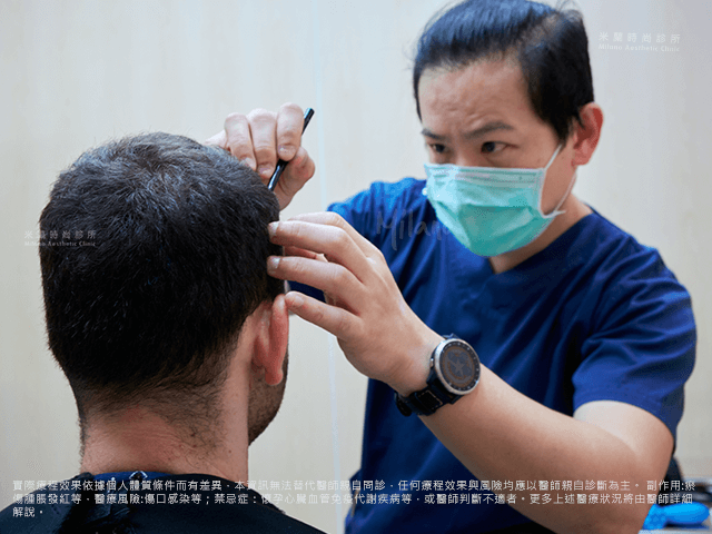 植髮諮詢評估與規劃 圖片
