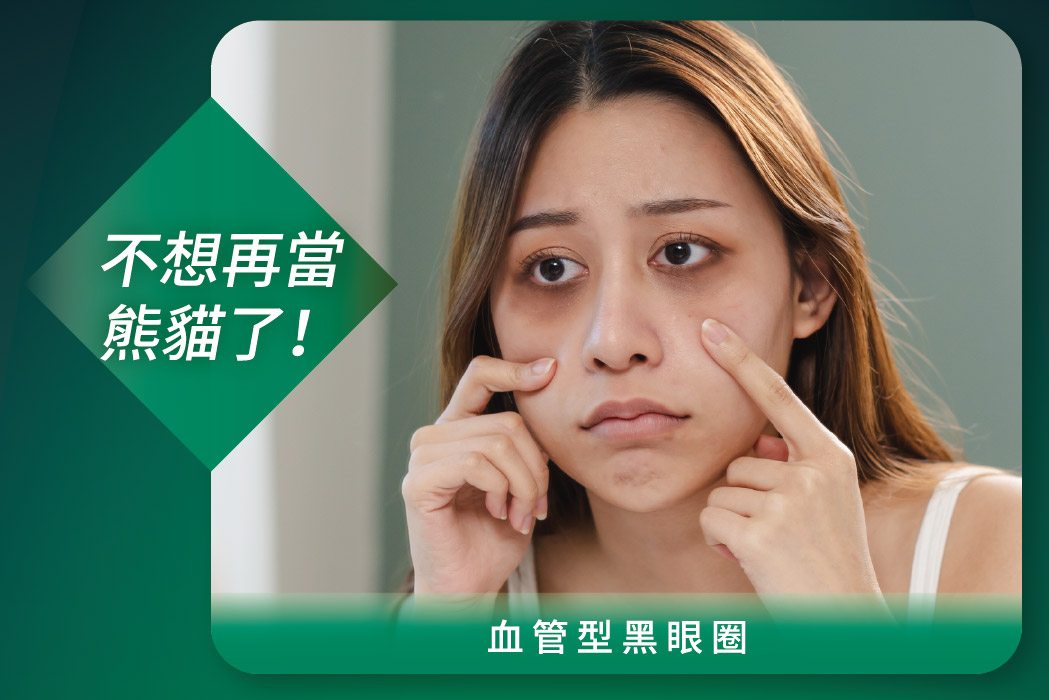 血管型黑眼圈