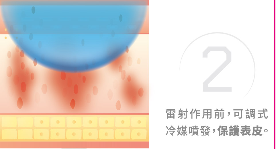 青萃光治療原理圖解2
