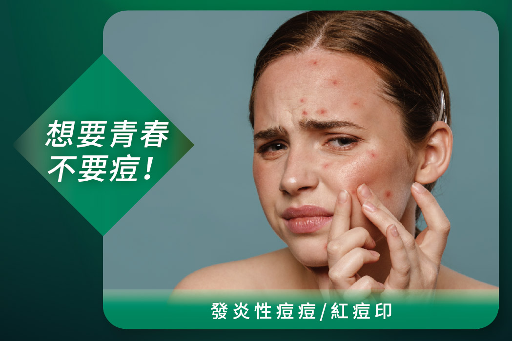 發炎性痘痘/紅痘印