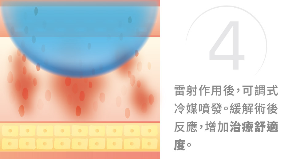 青萃光治療原理圖解4