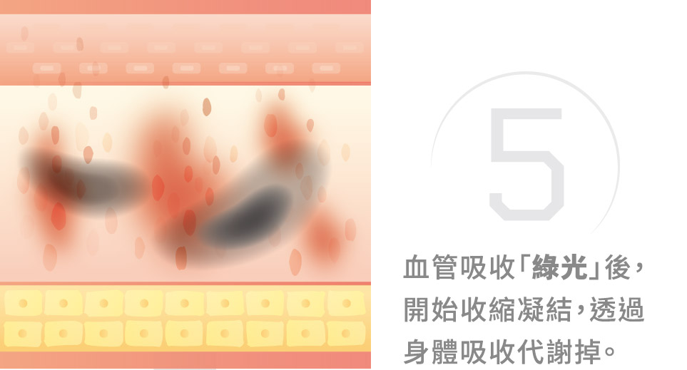 青萃光治療原理圖解5