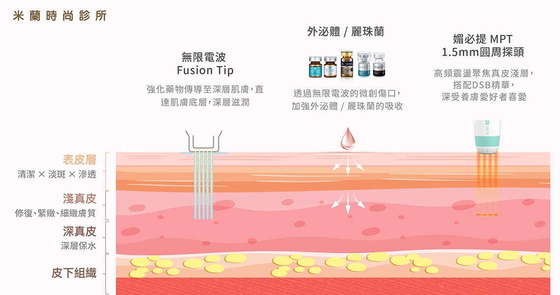 無限電波微創傳導、外泌體麗珠蘭導入及媚必提MPT深層聚焦療程示意圖