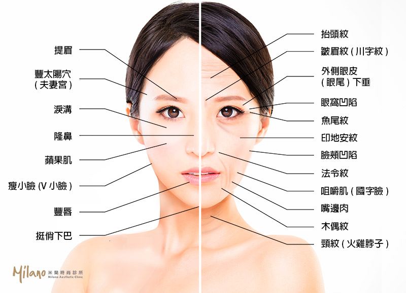 玻尿酸針對材質的不同適用於臉部的部位也不一樣，