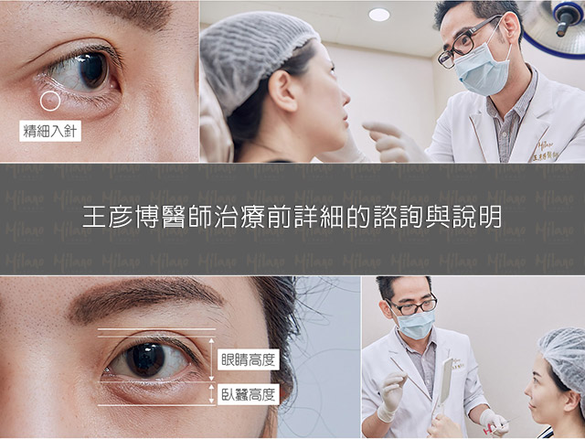 王彥博醫師視其條件及需求，進行婷婷臥蠶眼微整形規劃和施打玻尿酸