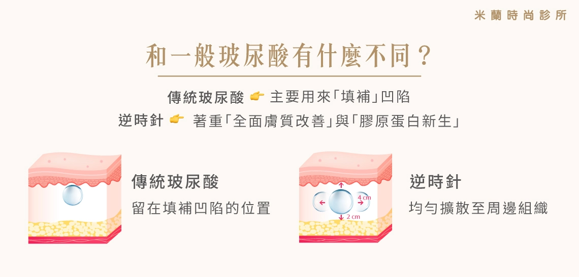 PROFHILO逆時針和一般玻尿酸有什麼不同