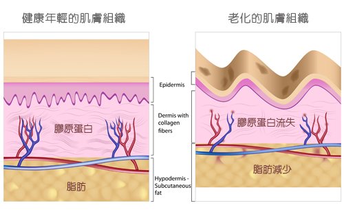 肌膚老化過程圖片