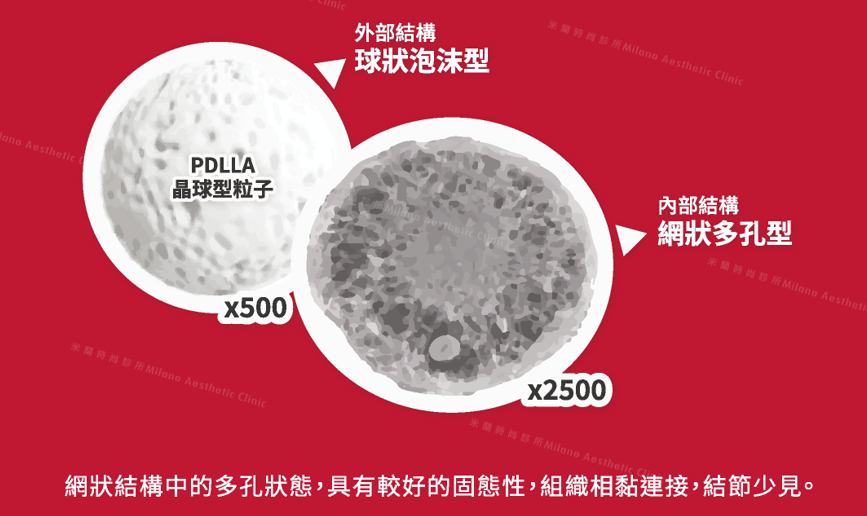 薇貝拉示意圖