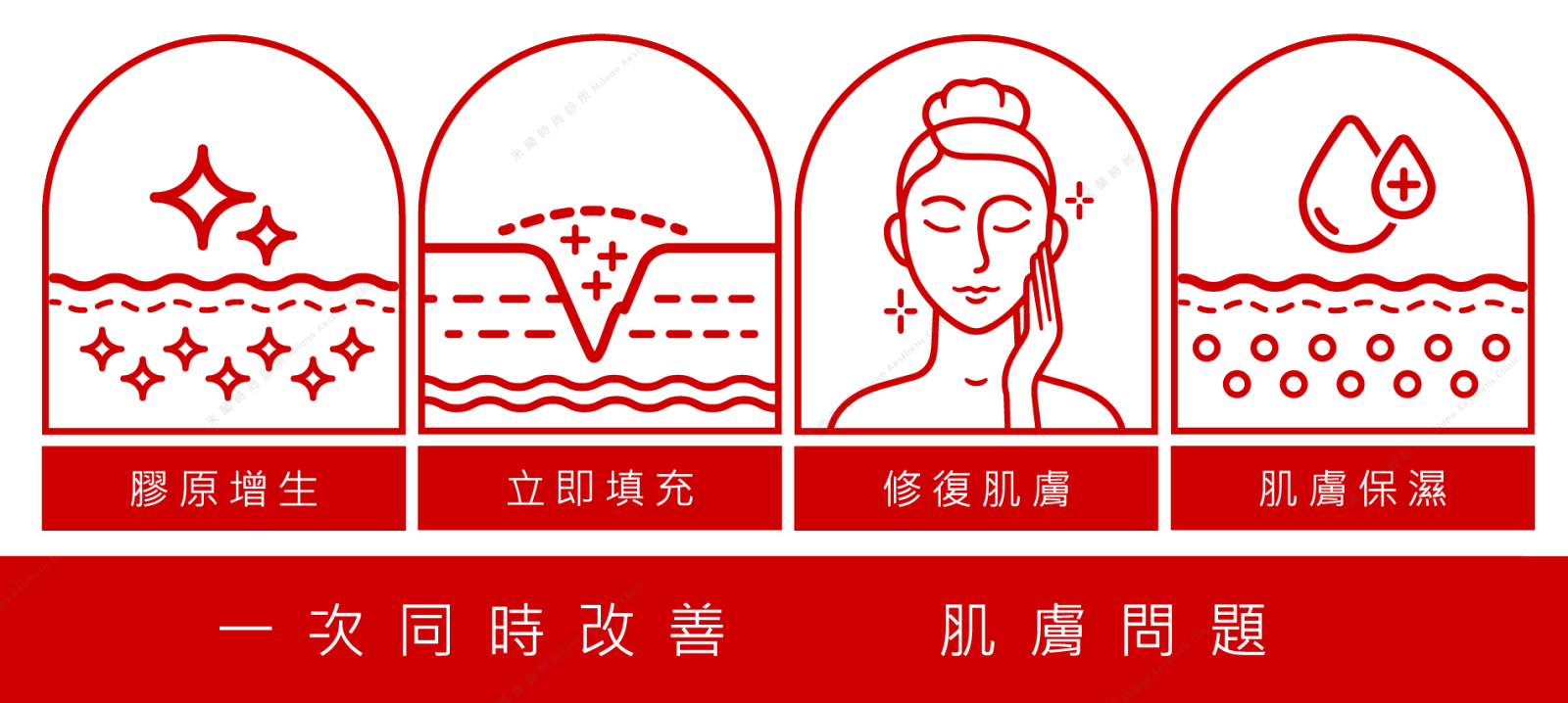 薇貝拉示意圖