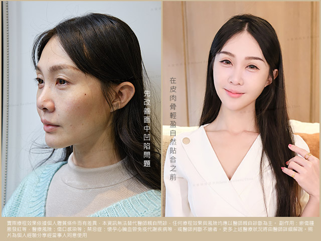 輕盈立體的骨相美