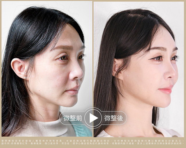 輕盈立體的骨相美
