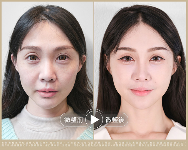輕盈立體的骨相美
