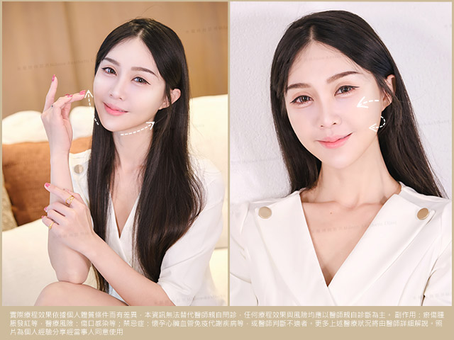 輕盈立體的骨相美