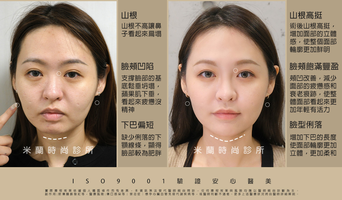 術前術後比一比 照片