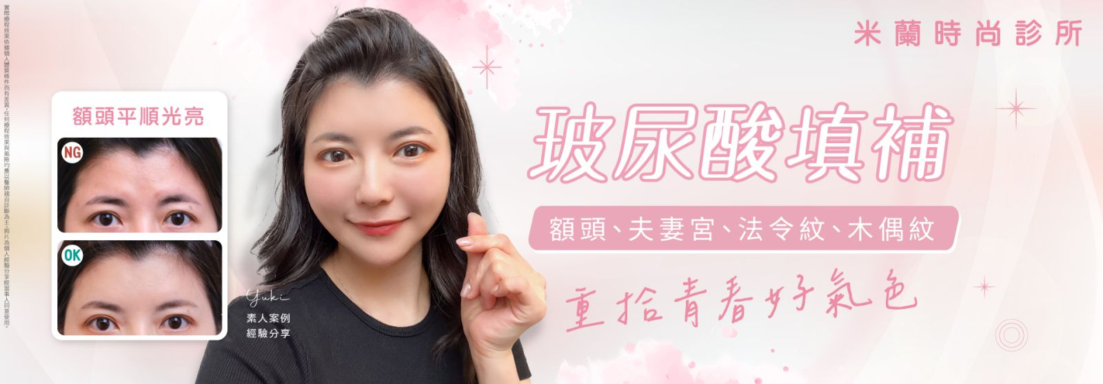 原來臉蛋有這些陰影會顯老