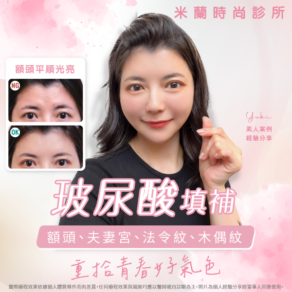 原來臉蛋有這些陰影會顯老