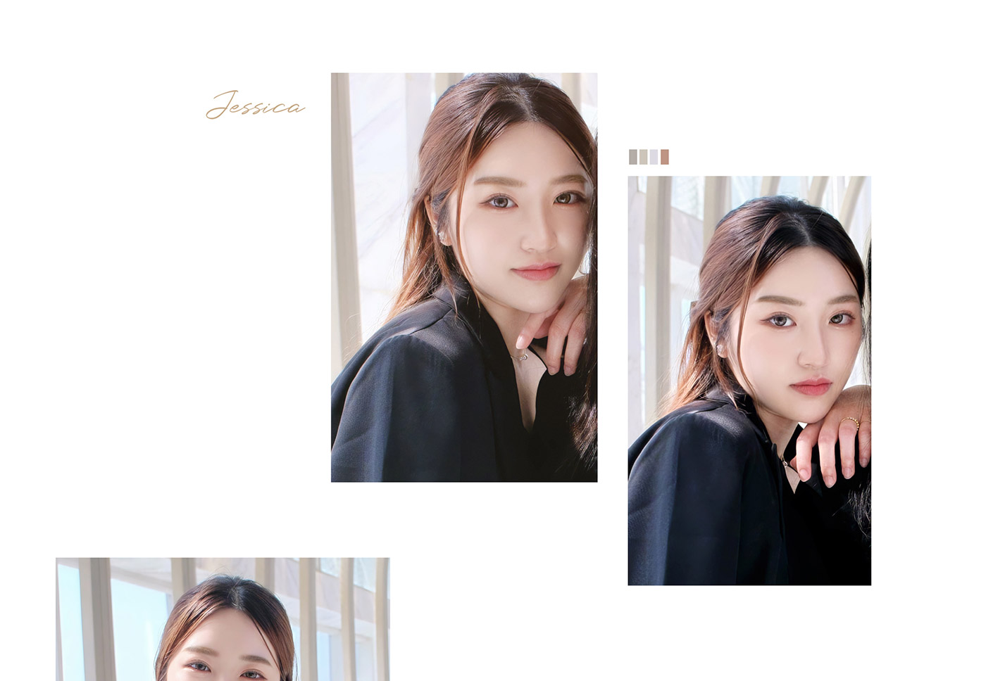 Jessica術後展現成果