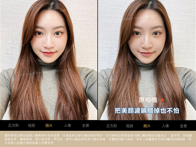 術前術後比一比 照片