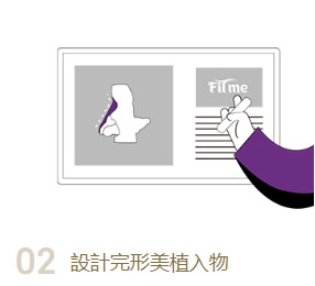 設計完行美植入物