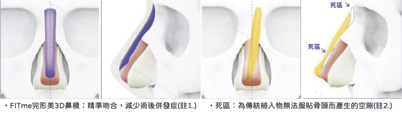 提升美感與安全性