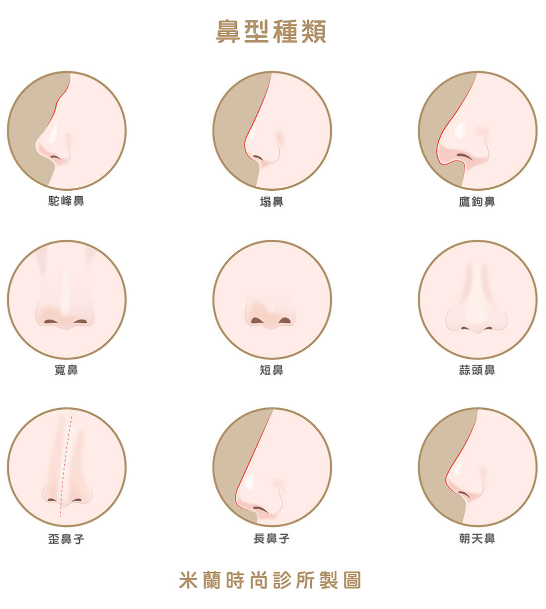 亚洲人的鼻梁竟然不是最低的！世界三大人种鼻子的鼻型差异你知道_顾清_主治医师_爱问健康