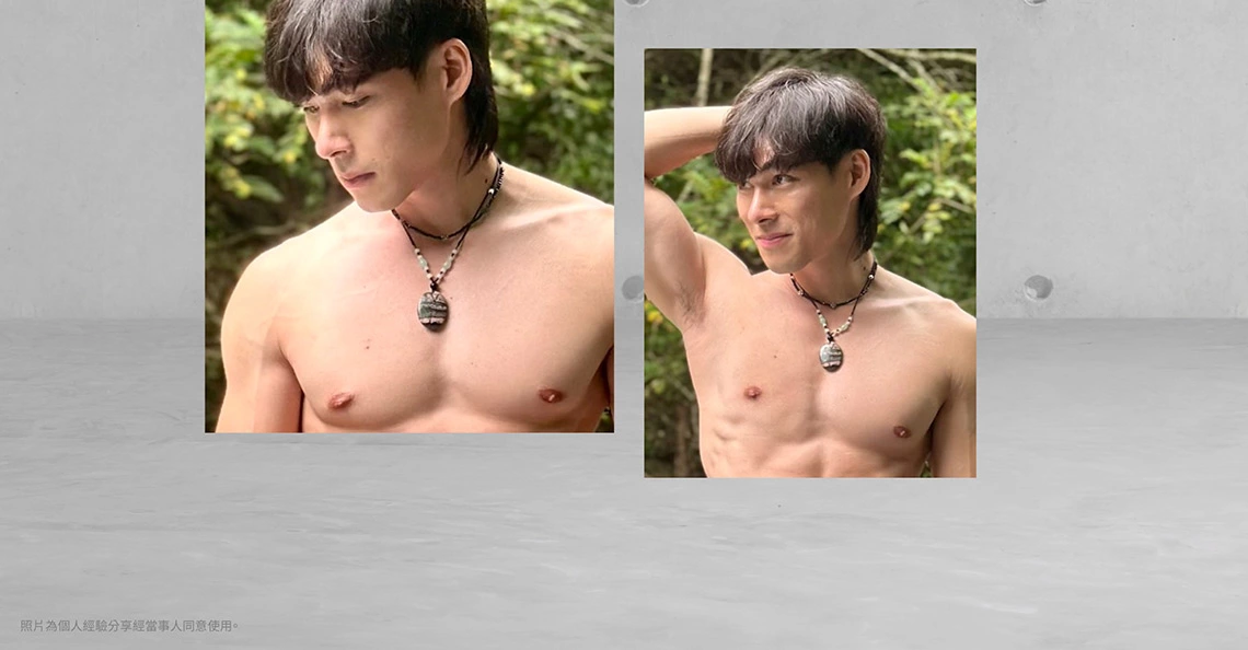晏然術後生活照