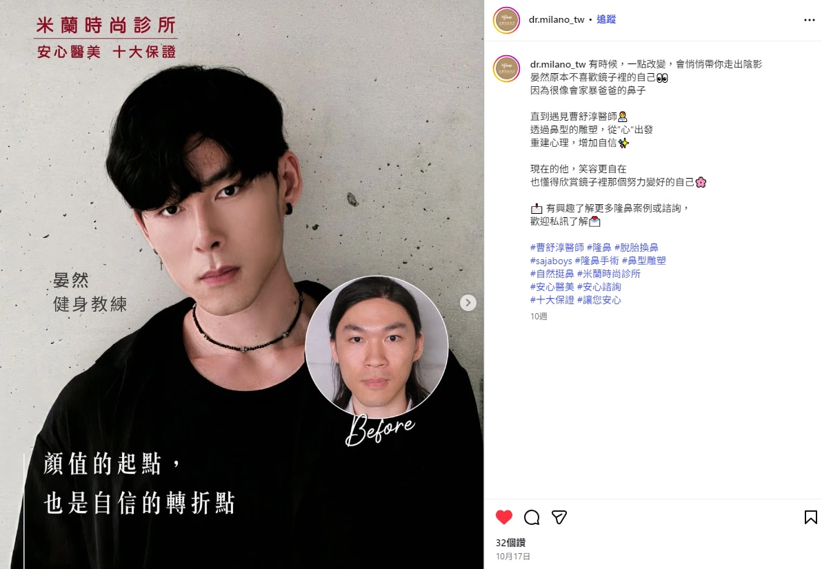 完整前後對比與故事IG案例分享
