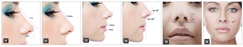 藉由隆鼻手術調整臉型並改善原有鼻型的缺點