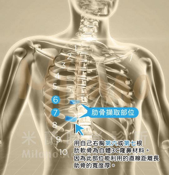 右胸第六或第七根肋軟骨為材料
