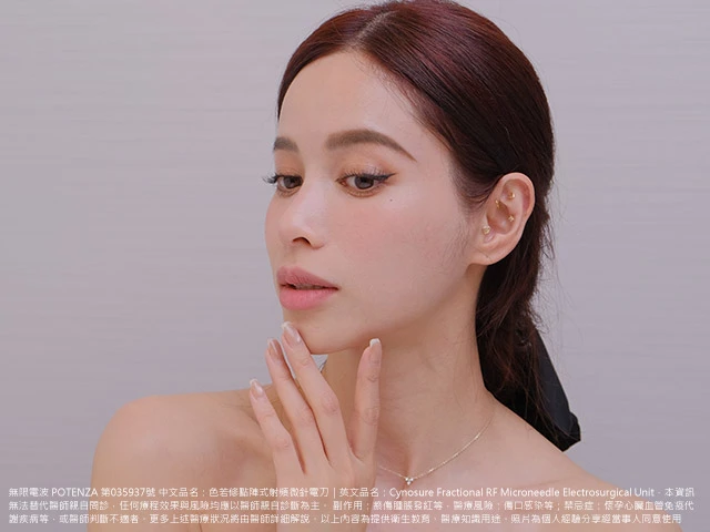 做完療程後的女神Nikki，皮膚好到發亮，側臉線條也很緊緻。