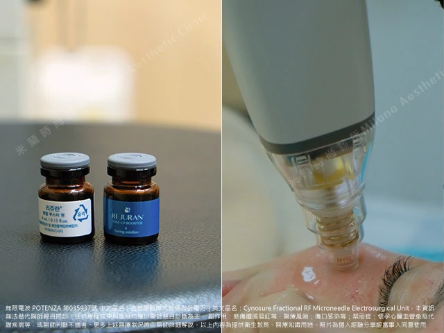 透過微針射頻技術無限電波將麗珠蘭深入肌膚層幫助恢復肌膚彈性
