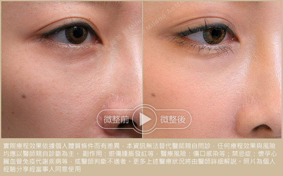 麗珠蘭Booster保養系列