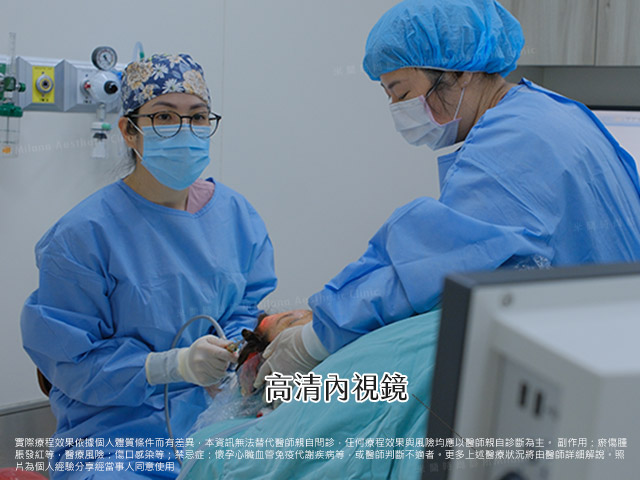 高清內視鏡前額拉皮手術