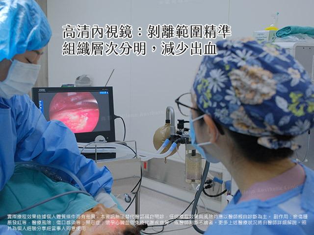 高清內視鏡前額拉皮手術