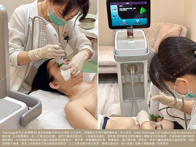 FLX眼周電波術中